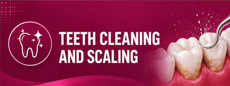 Teeth Cleaning & Scaling